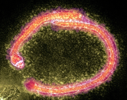 Image: Image: Colored transmission electron micrograph (TEM) of Ebolavirus particles (Photo courtesy of Hazel Appleton, Center for Infections / Health Protection Agency).